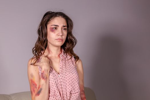 violence issues - Woman victim of domestic violence and abuse over grey background.