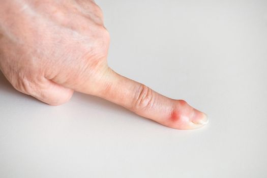 Sick female fingers of an elderly man's hands on a white background.