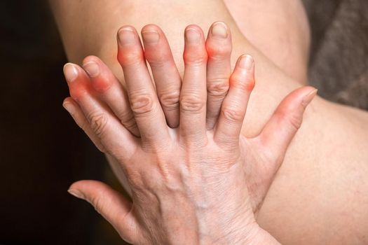 Elderly woman's hands with sore fingers. Finger treatment concept.