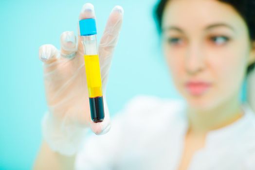 Doctor with a test tube of blood and plasma