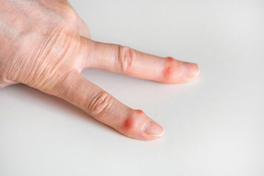 Sick female fingers of an elderly man's hand on a white background.