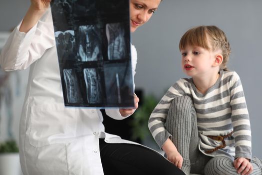 Woman doctor shows little girl an X-ray of spine. Curvature of spine and scoliosis in children