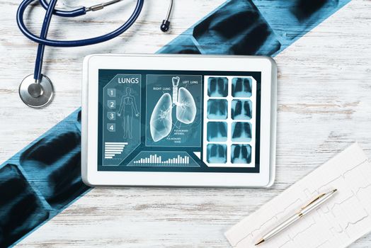 Medical diagnostics in modern pulmonology. Tablet computer with medical application interface on screen. Top view x-ray image, stethoscope and cardiogram on desk. Digital tuberculosis screening test