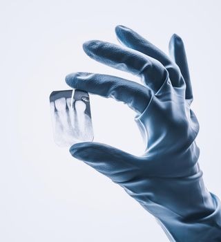 Closeup of hand in white glove holding small dental x-ray isolated on white background