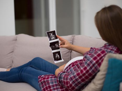 Young pregnant woman looking baby's ultrasound photo while relaxing on sofa at home