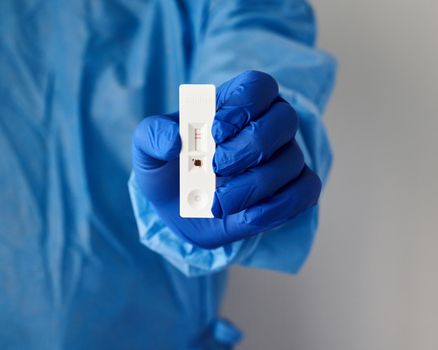 Unrecognizable doctor holds in hand positive test for antibodies to covid-19 virus. Bright blue coat, hand close up. Express test for coronavirus