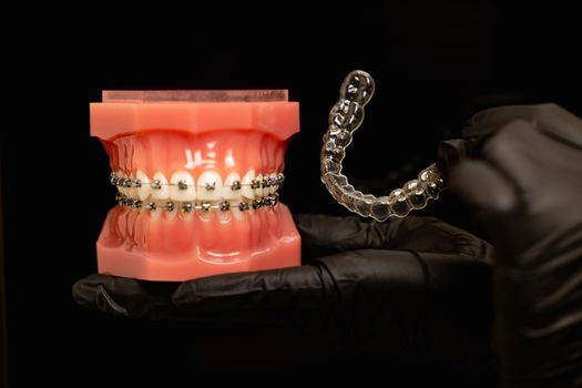 Close-up shot of doctors hands in black gloves holding silicone mouth guard and models of teeth with ceramic braces on teeth on an artificial jaw. High quality photo