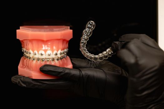 Close-up shot of doctors hands in black gloves holding silicone mouth guard and models of teeth with ceramic braces on teeth on an artificial jaw. High quality photo