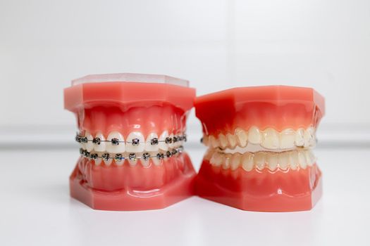 mouth guard and models of teeth with braces on teeth on a jaw. High quality photo