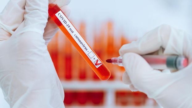 close up. scientist puts a check mark on the tube with the test. photo with a copy-space.