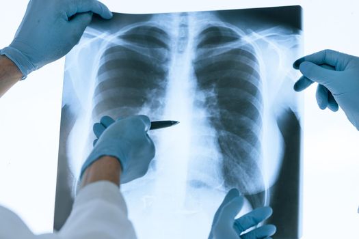 close up. medical colleagues discussing an x-ray of the lungs . concept of health protection.