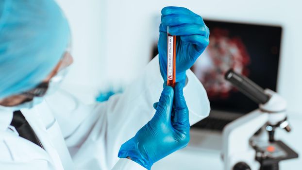 close up. tube with a tested test in the hands of a virologist. photo with a copy-space.