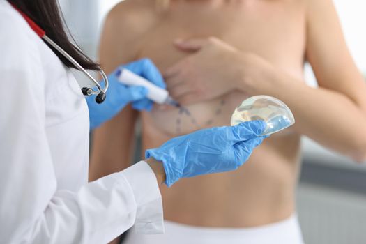 Doctor drawing preoperative marking on patient chest and holding implant closeup. Plastic surgery breast augmentation concept