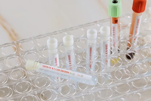 Diagnostic testing for COVID-19 new version Omicron laboratory test in hospital lab medical science professional taking sample test tube