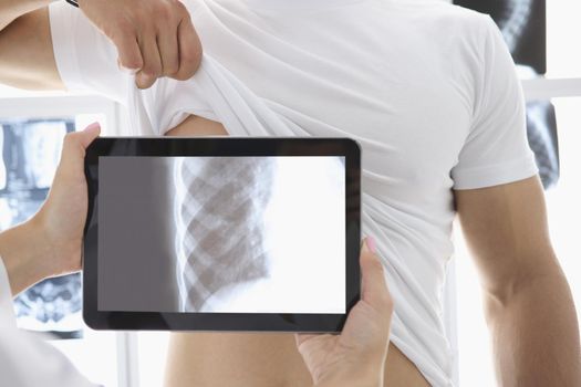 Close-up of medical worker put tablet device on patients body part and see ribs. Fast development of medicine. Modern technology, medicine, checkup concept