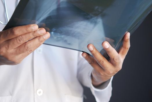doctor hold analyzing xray photography closeup