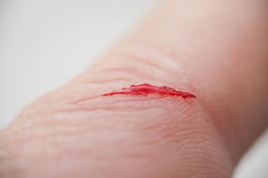 Close-up of injured person finger with bleeding blood on open cut wound. Cut made with sharp knife. Pain, ache, hurting, medical help needed, wound concept