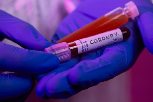 Coronavirus, Doctor holding positive covid-19 virus Blood Sample test tube and medicine cure drug