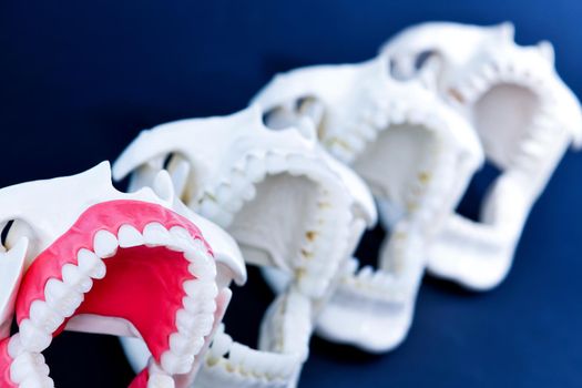 Dentist orthodontic teeth models with jaws opened on blue background