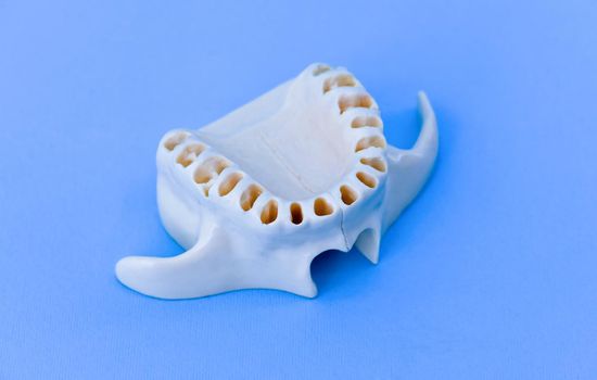 Upper human jaw without teeth model medical illustration isolated on blue background. Healthy teeth, dental care and orthodontic concept