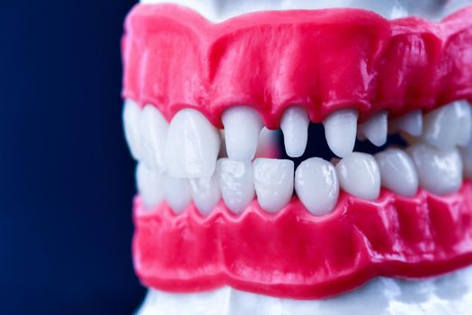 Human jaw with teeth and gums anatomy model medical illustration isolated on blue background. Healthy teeth, dental care and orthodontic concept