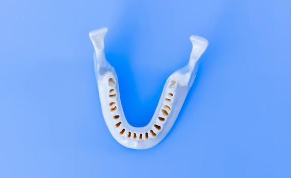 Lower human jaw without teeth model medical illustration isolated on blue background. Healthy teeth, dental care and orthodontic concept