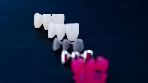 different types of dental tooth crowns isolated on blue background