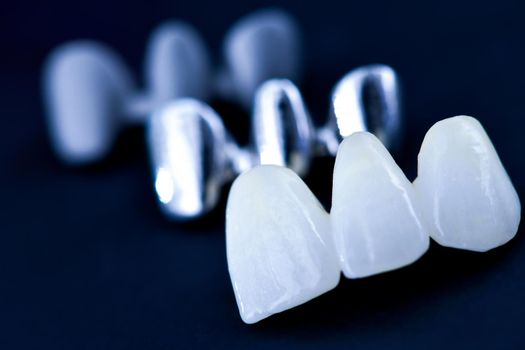 different types of dental tooth crowns isolated on blue background