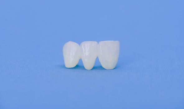 Metal free ceramic dental crowns isolated on a blue background