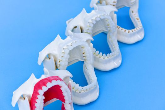 Dentist orthodontic teeth models with jaws opened on blue background