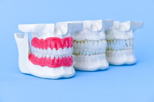 Human jaws with teeth and gums anatomy models medical illustration isolated on blue background. Healthy teeth, dental care and orthodontic concept