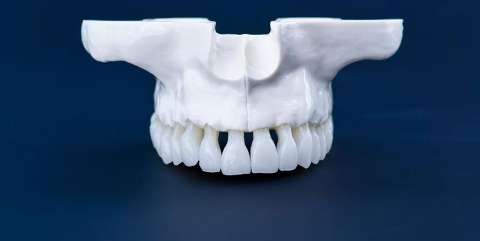 Upper human jaw with teeth anatomy model medical illustration isolated on blue background. Healthy teeth, dental care and orthodontic concept