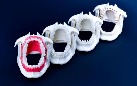 Dentist orthodontic teeth models with jaws opened on blue background