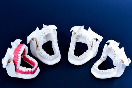 Dentist orthodontic teeth models with jaws opened on blue background