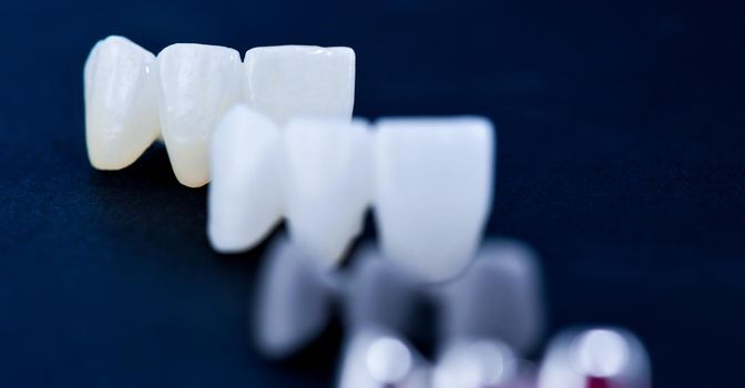 different types of dental tooth crowns isolated on blue background