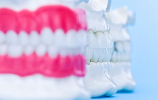 Human jaws with teeth and gums anatomy models medical illustration isolated on blue background. Healthy teeth, dental care and orthodontic concept