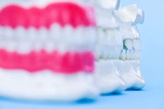 Human jaws with teeth and gums anatomy models medical illustration isolated on blue background. Healthy teeth, dental care and orthodontic concept