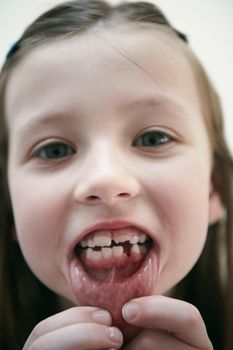 Funny little girl without tooth smiles showing gap close up