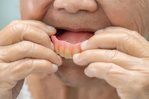 Asian senior or elderly old woman patient holding to use denture in nursing hospital ward, healthy strong medical concept