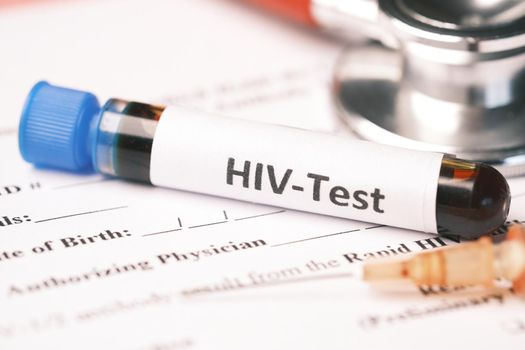 HIV blood test tube and prescription on table ,