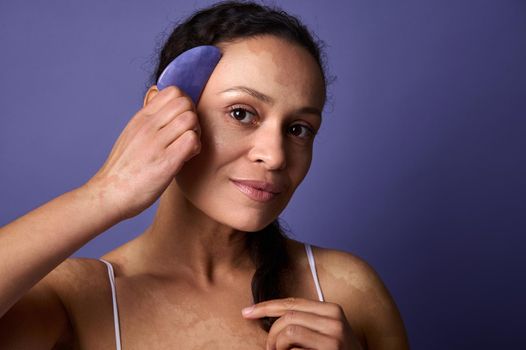 Charming middle aged woman with vitiligo smiles cutely looking at camera, holding Gua-Sha jade stone massager near her face. Purple background with copy ad space. Dermatology and skin problems concept