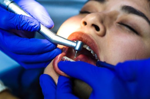 Female patient at dental procedure using dental drill in modern dental clinic