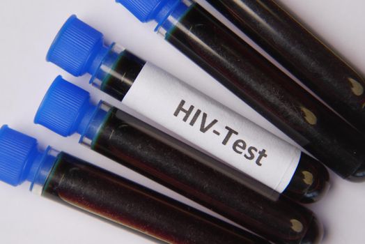 HIV blood test tube and prescription on table ,