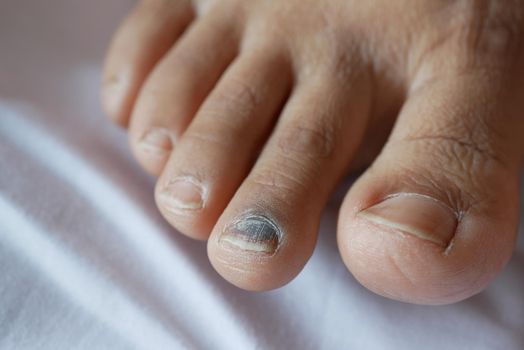close up of women feet fingers on bed