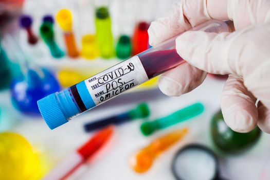 Omicron blood test. Corona virus, Covid - 19 positive blood test tube in laboratory, glassware and reagents in lab