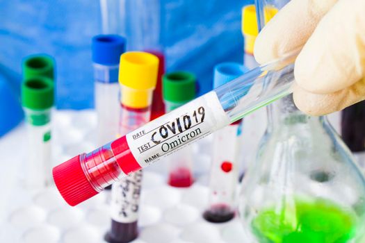 Covid - 19 and corona virus blood test sample, omicorn blood test in doctors hand