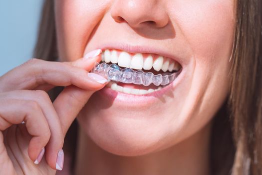 Woman with perfect smile wearing invisible dental aligners for dental correction. High quality photo