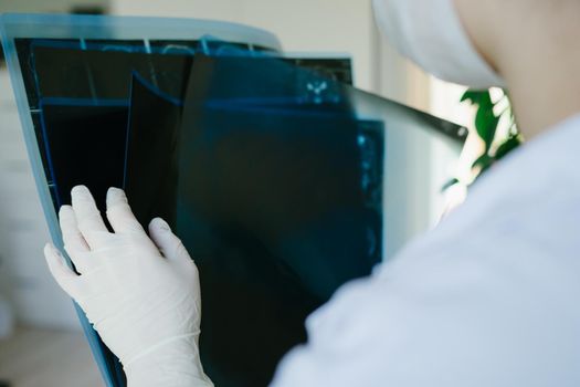 The girl doctor's is holding X-ray examinations in her hands. The doctor's hands are gloved. Doctor works on the front line.