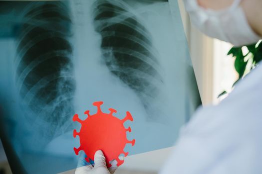 The doctor holds an X-ray examination of the patient's chest in his hands. X-ray is in the doctor's hands. Red symbol is covid-19. Omicron is the newest strain of the virus.