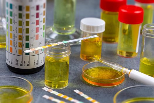 Conceptual image on urinary analysis Urin Tests Measurement close up view